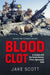 Blood Clot