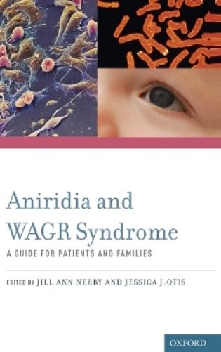Aniridia and WAGR Syndrome