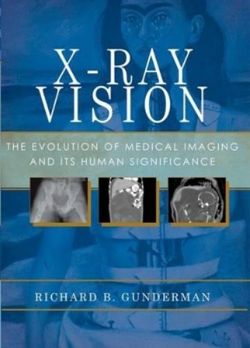 X-Ray Vision