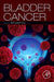 Bladder Cancer
