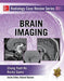 Radiology Case Review Series: Brain Imaging