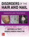 Disorders of the Hair and Nail: Diagnosis and Treatment