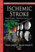 Ischemic Stroke