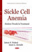 Sickle Cell Anemia