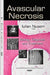Avascular Necrosis