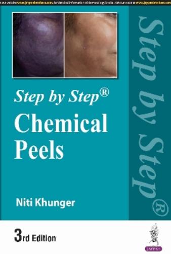 Step by Step: Chemical Peels