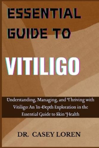 Essential Guide to Vitiligo