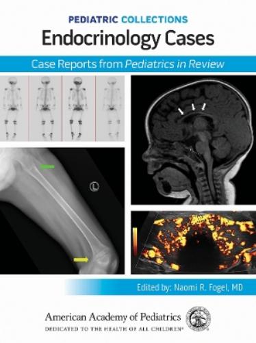 Endocrinology Cases