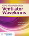Rapid Interpretation of Ventilator Waveforms