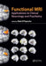 Functional MRI