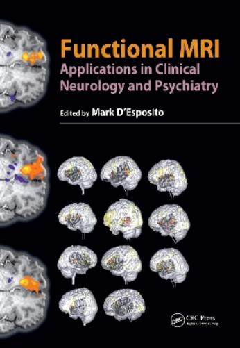 Functional MRI