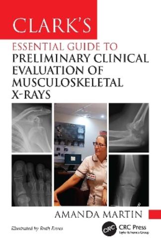 Clark’s Essential Guide to Preliminary Clinical Evaluation of Musculoskeletal X-rays