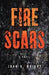 Fire Scars