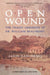 Open Wound