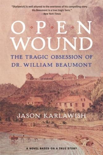 Open Wound