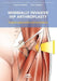 Minimally Invasive Hip Arthroplasty