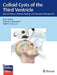 Colloid Cysts of the Third Ventricle
