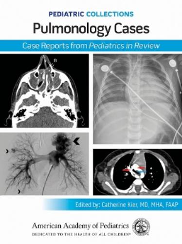Pulmonology Cases