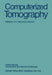 Computerized Tomography