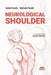 Neurological Shoulder