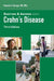 Questions and Answers About Crohn's Disease