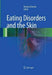 Eating Disorders and the Skin