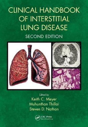 Clinical Handbook of Interstitial Lung Disease
