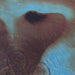 Meddle