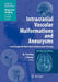 Intracranial Vascular Malformations And