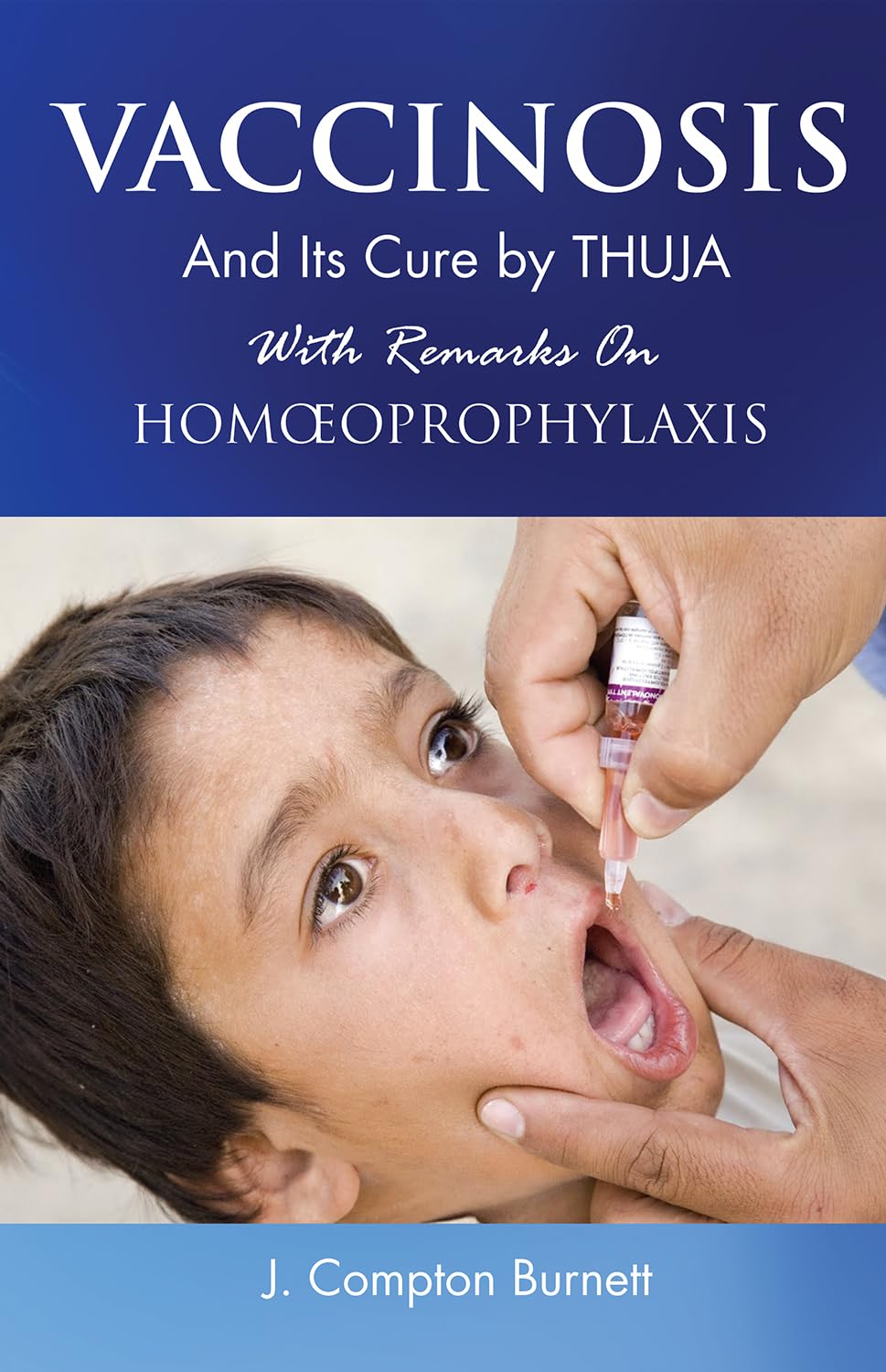 Vaccinosis & its Cure by Thuja