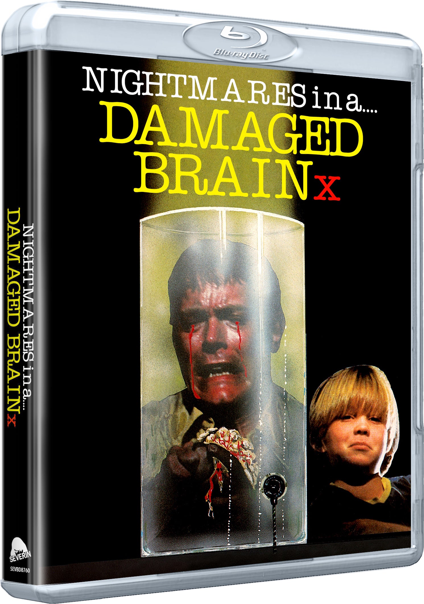 Nightmares in a Damaged Brain