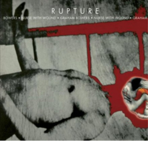 Rupture
